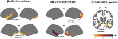 Structural development and brain asymmetry in the fronto-limbic regions in preschool-aged children